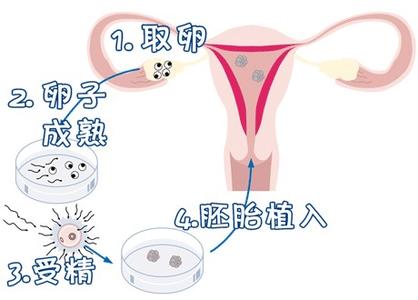 同性供卵代怀服务怎么收费